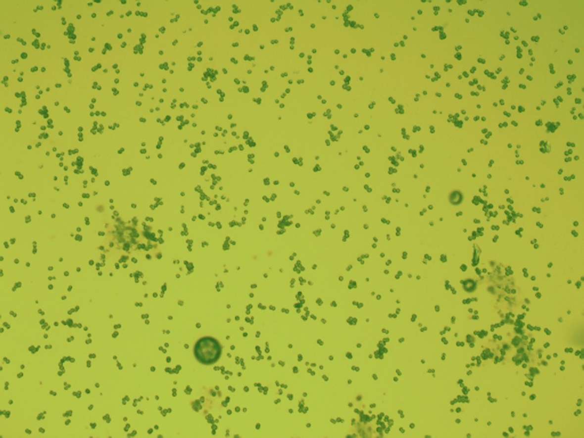 On the picture you can see a simple enlargement of algae. Yellow background with the about 120 small and green coloured algae.