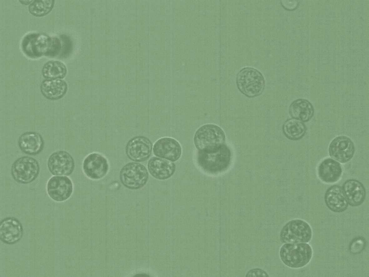 Here is a very high magnification of the algae, you can see about 15 algae. Their points appear larger.